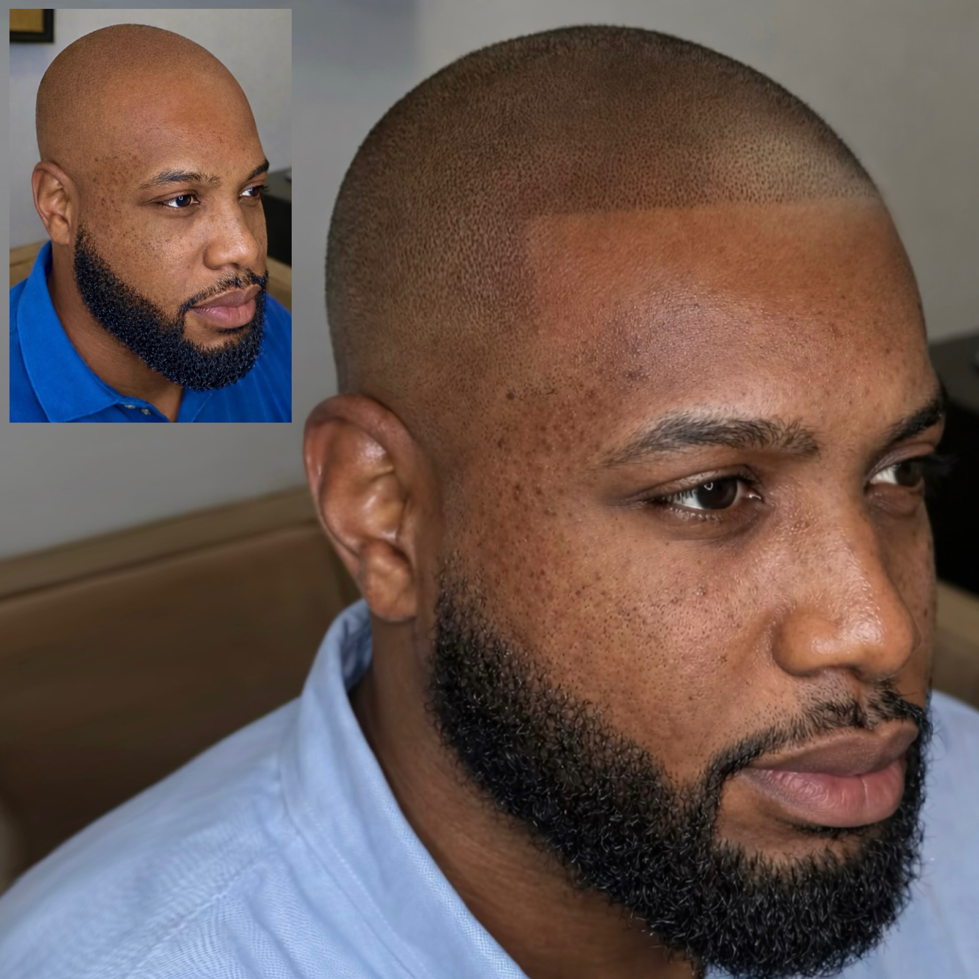 Scalpworx before and after result