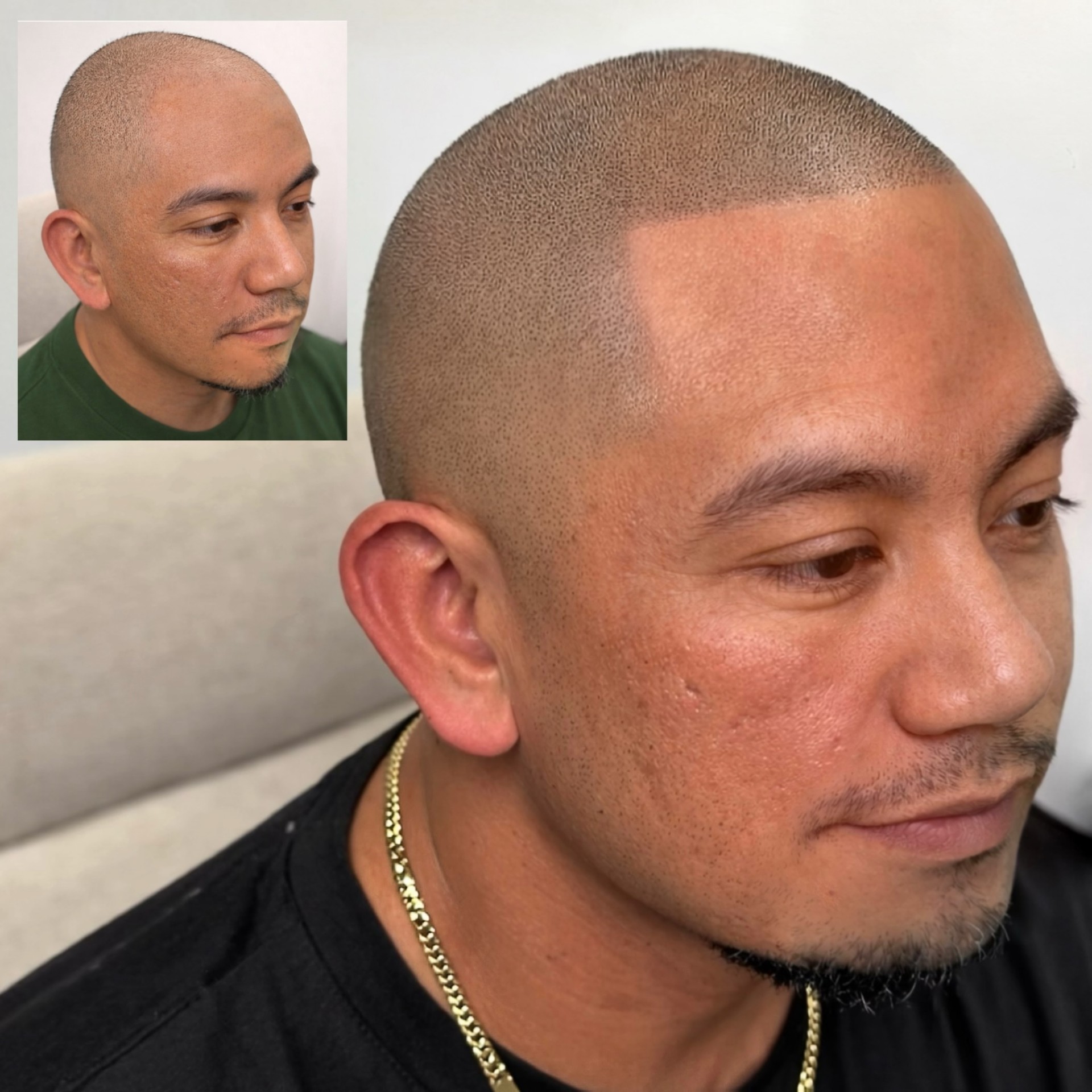Scalpworx before and after result