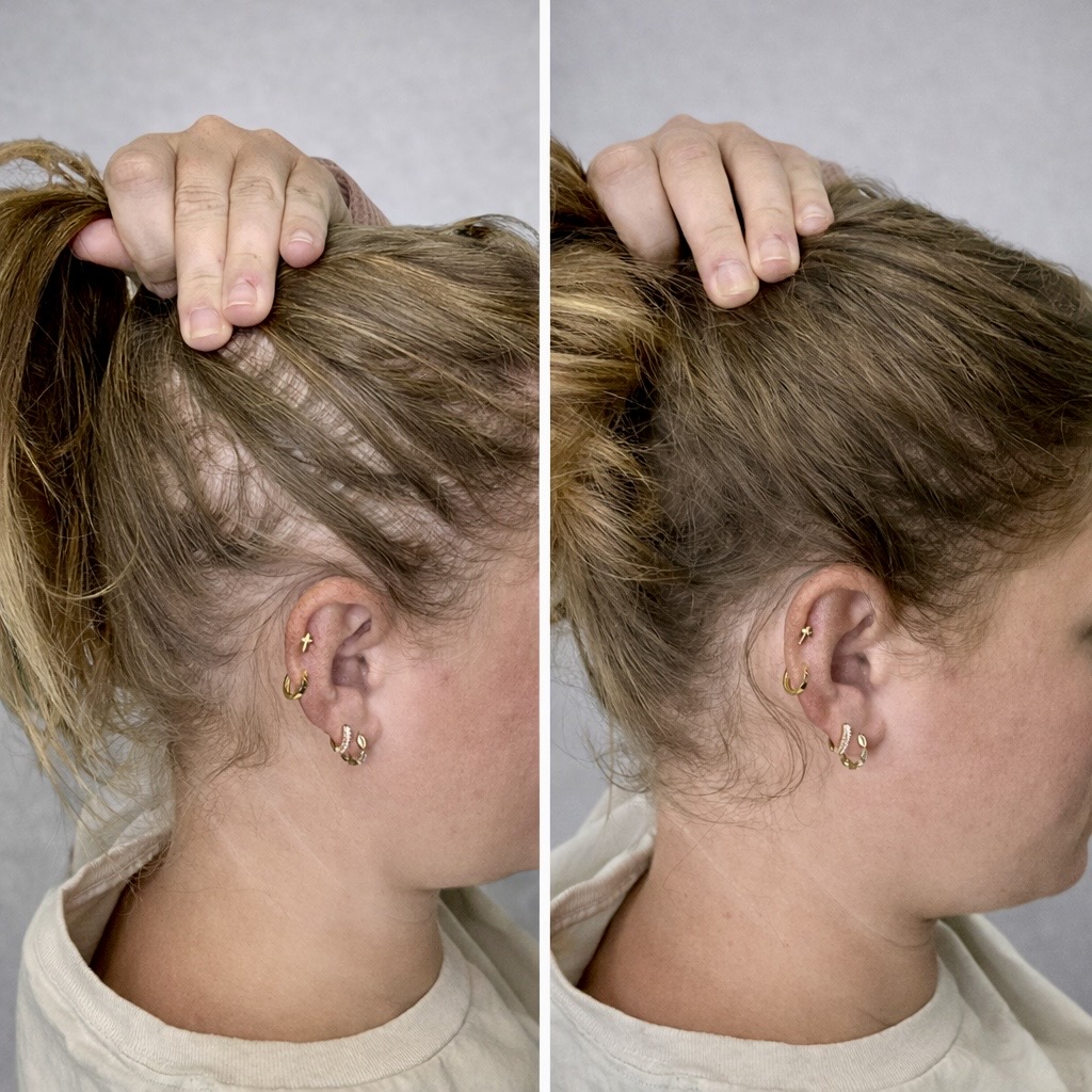 Scalpworx before and after result
