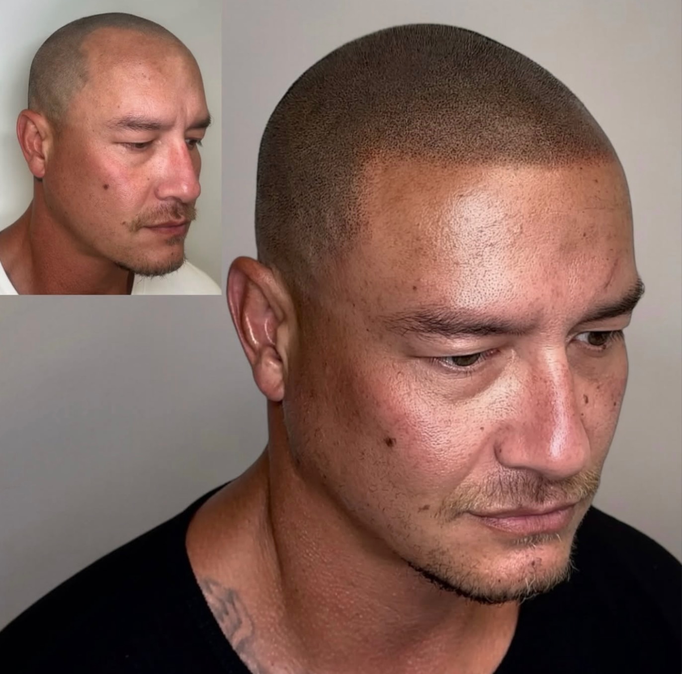 Scalpworx before and after result