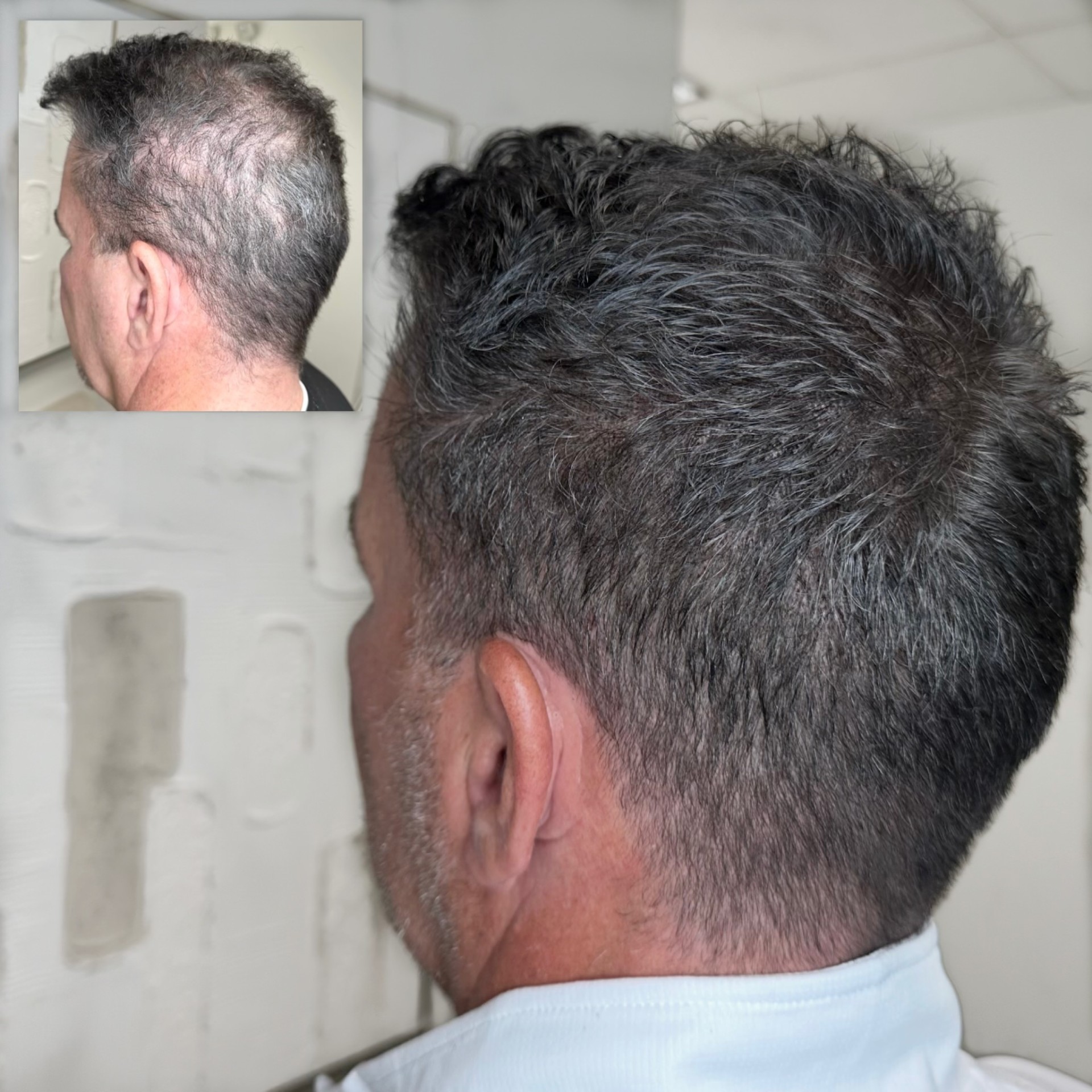 Scalpworx before and after result