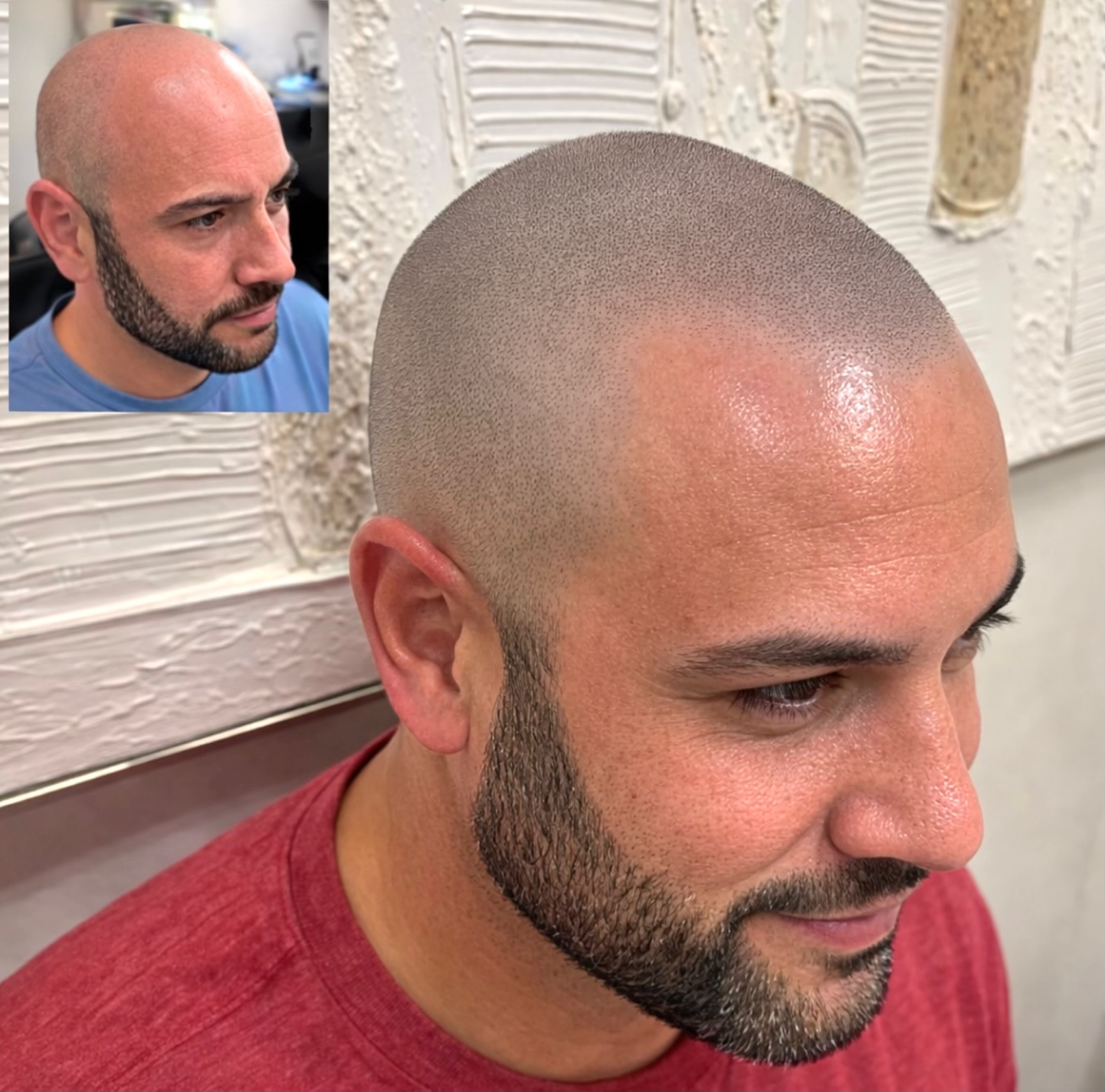 Scalpworx before and after result