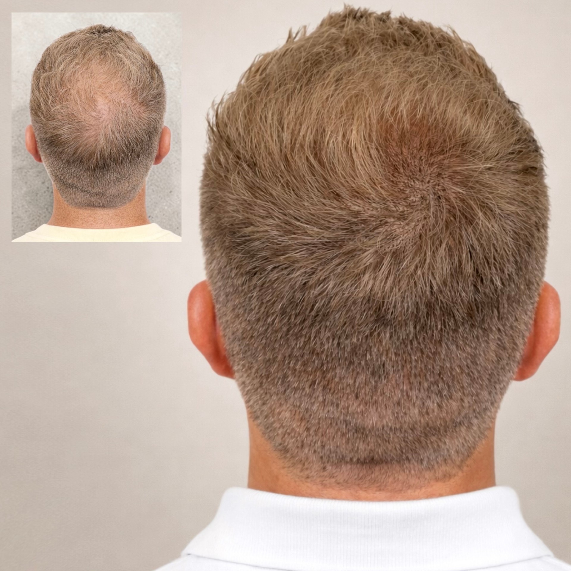 Scalpworx before and after result